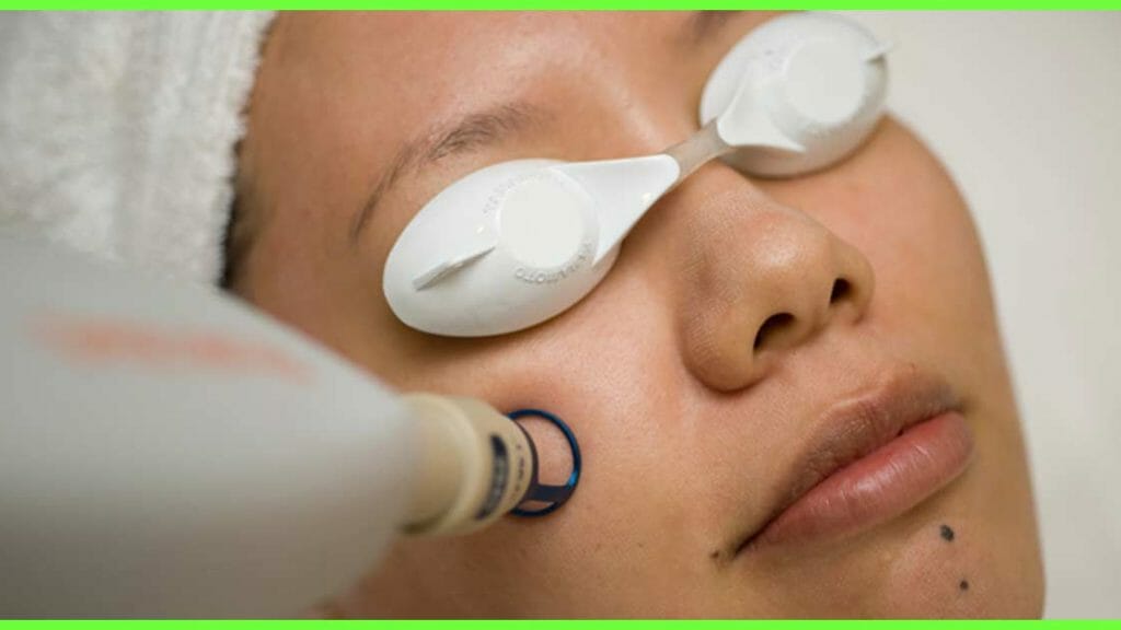 Side Effects Of Laser Hair Removal You Should Know About WPC Trends   9 Side Effects Of Laser Hair Removal Treatment That You Should Definitely Know 1 1024x576 